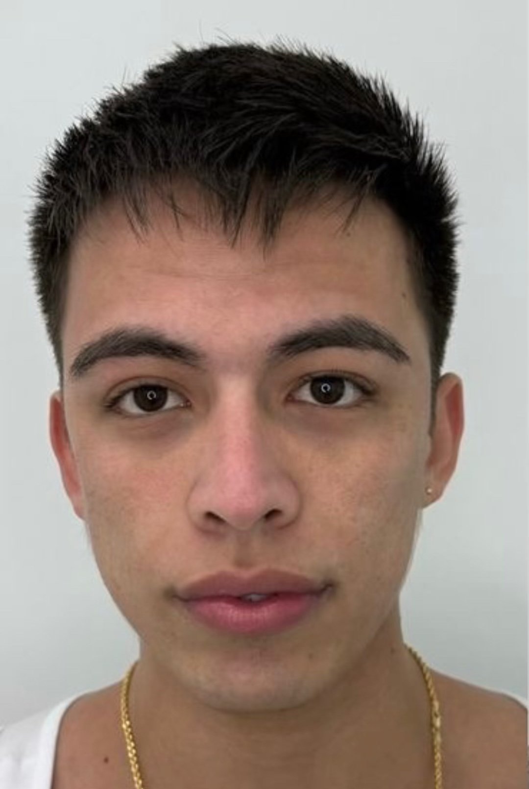 Marcos — before VISAGE protocol